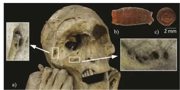 Figure 414 a Location of Calliphoridae dipteran puparia on the mummys face - фото 20