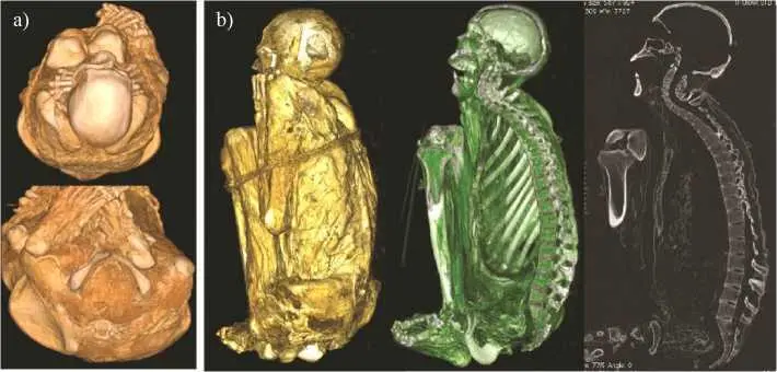 Figure 45 Examples of images of the mummy obtained from CT imaging a Views - фото 11