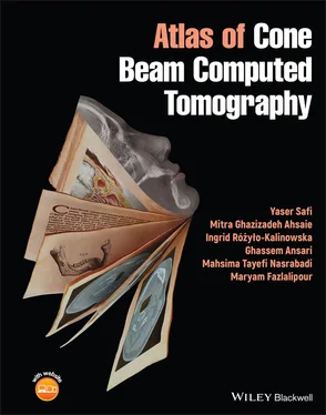 Ghassem Ansari Atlas of Cone Beam Computed Tomography обложка книги