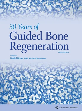 Daniel Buser 30 Years of Guided Bone Regeneration обложка книги