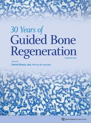 Daniel Buser - 30 Years of Guided Bone Regeneration