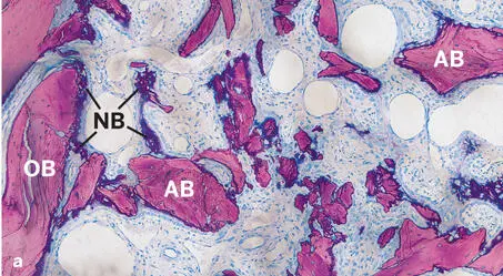 Fig 242Histologic sections of standardized bone defects in the minipig - фото 112