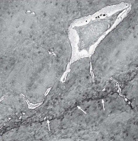 Fig 216Transmission electron micrograph showing a cement line arrows at the - фото 72