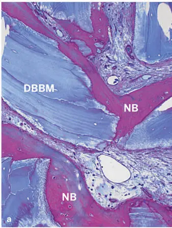 Fig 239Histologic sections of human biopsy specimens grafte - фото 106