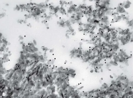 Fig 247 a Ultrathin section of a human biopsy specimen retrieved from a bony - фото 121