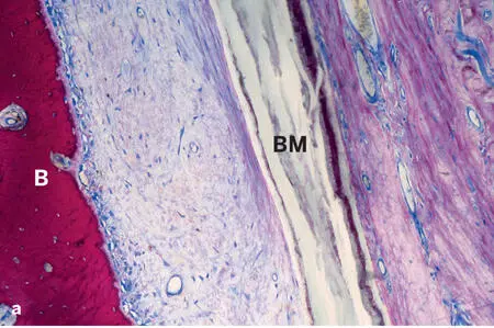 Fig 218Soft and hard tissue compartments adjacent to an ePTFE barrier membrane - фото 74