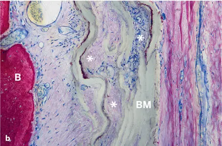 Fig 218Soft and hard tissue compartments adjacent to an ePTFE barrier membrane - фото 75