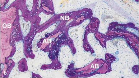 Fig 242Histologic sections of standardized bone defects in the minipig - фото 113