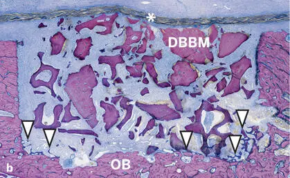 Fig 241Histologic sections of standardized bone defects in the minipig - фото 111