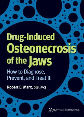 Robert E. Marx Drug-Induced Osteonecrosis of the Jaws обложка книги