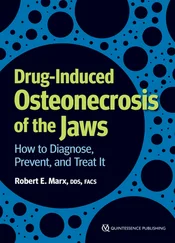 Robert E. Marx - Drug-Induced Osteonecrosis of the Jaws