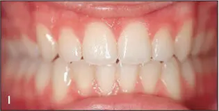 Fig 15Because the patient decided not to have surgery the compromise - фото 32