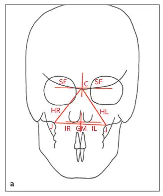 Fig 274 a Maxillary triangle b Mandi - фото 141