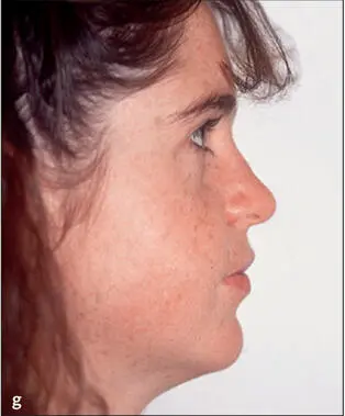 Fig 14This 20yearold patient was referred to the surgeon with the main - фото 20