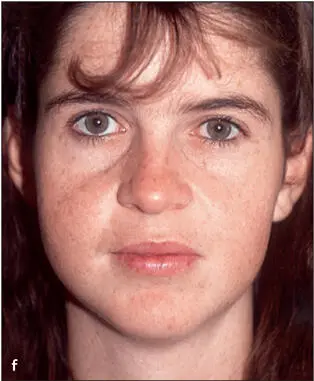 Fig 14This 20yearold patient was referred to the surgeon - фото 19