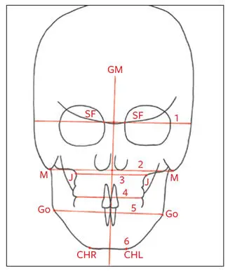 Fig 273Transverse posteroanterior and vertical planes 1 Cranial base plane - фото 140