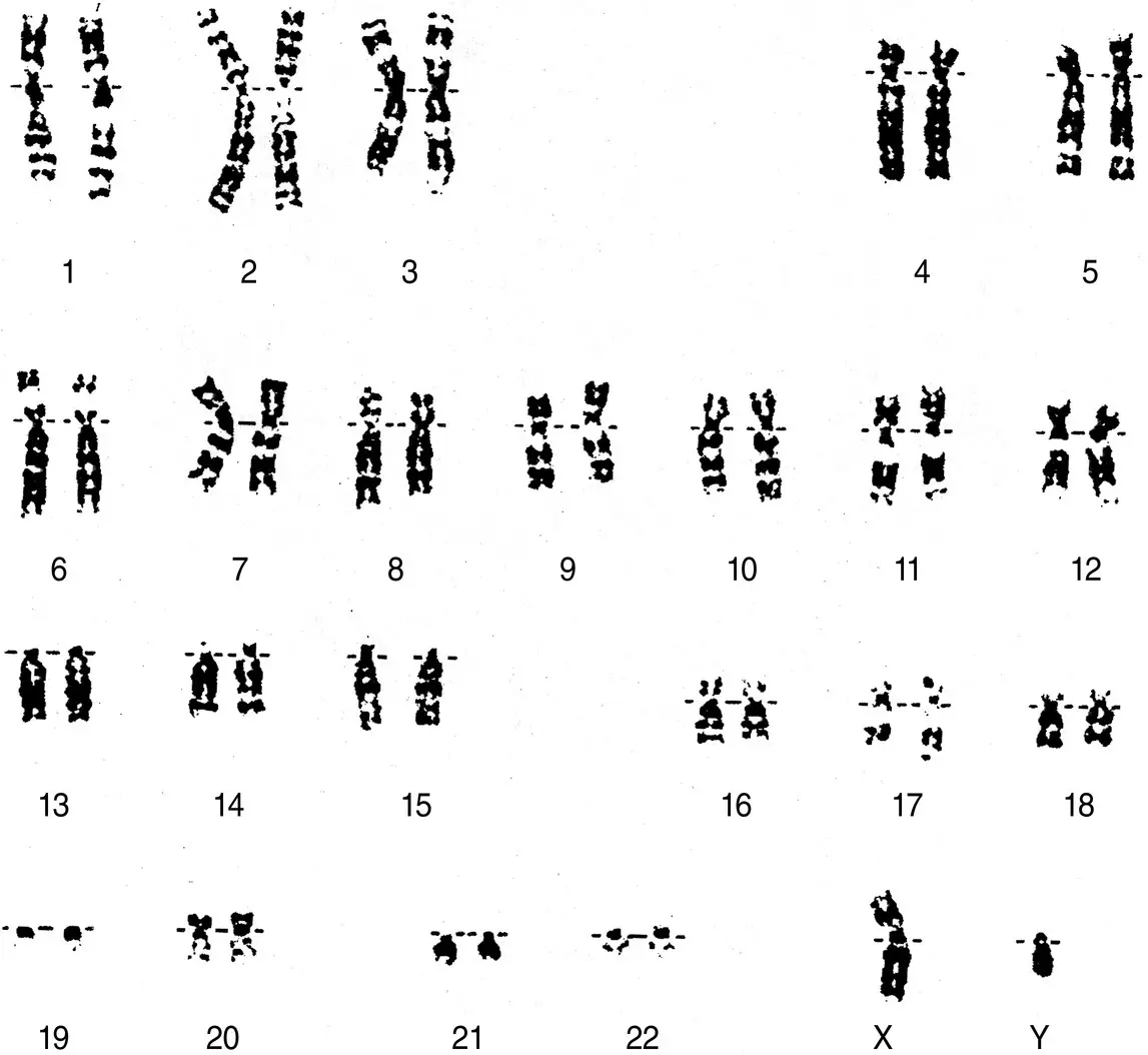 Figure 26 A Gbanded human male karyotype Source Courtesy of Mazin - фото 10