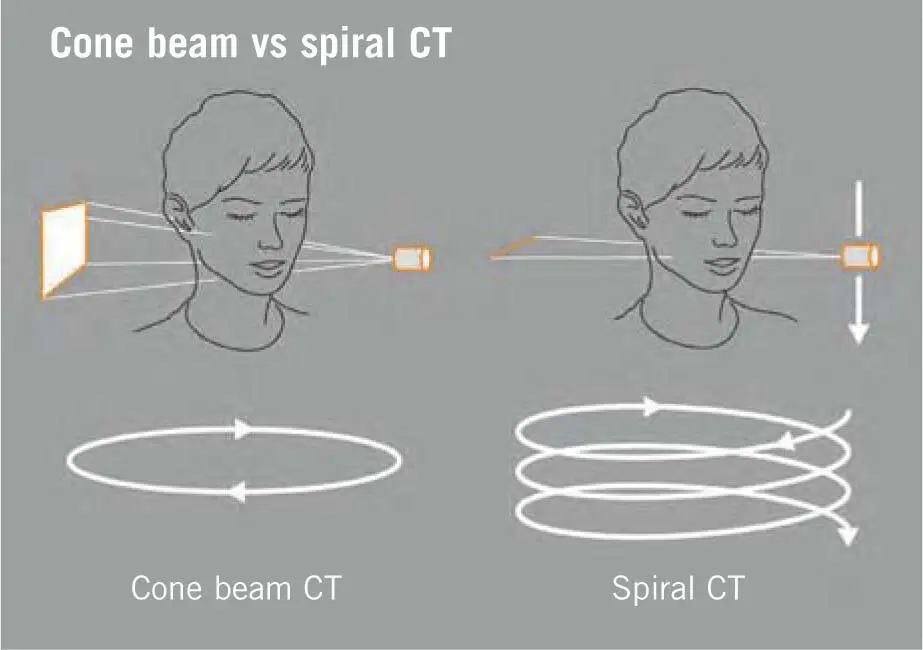 Fig 219aFunctional principle of cone beam technology with a conical beam that - фото 91