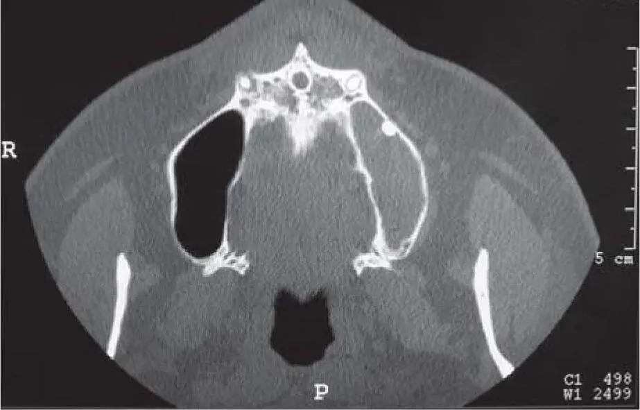Fig 218bA round foreign body is clearly visible on the lower caudal layer of - фото 87
