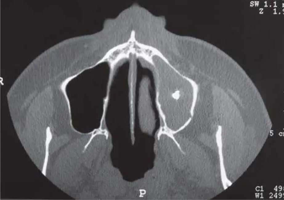 Fig 218cA second foreign body is also clearly visible on the higher layer - фото 88