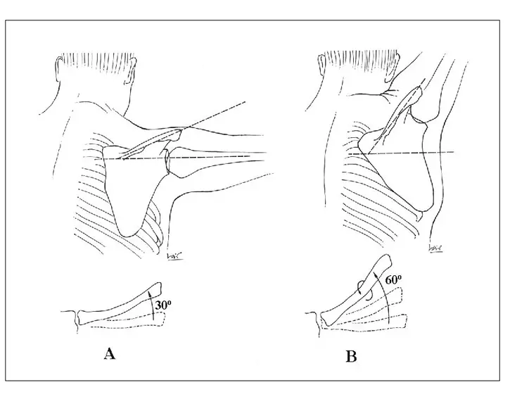 Fig 12 Ritme escapulohumeral A els primers 90º dabducció sassoleixen amb - фото 3