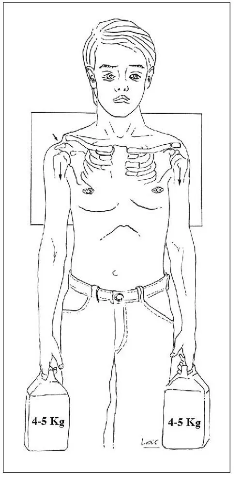 Fig 112 Exploració del signe de la tecla Pràctica duna radiografia simple - фото 13