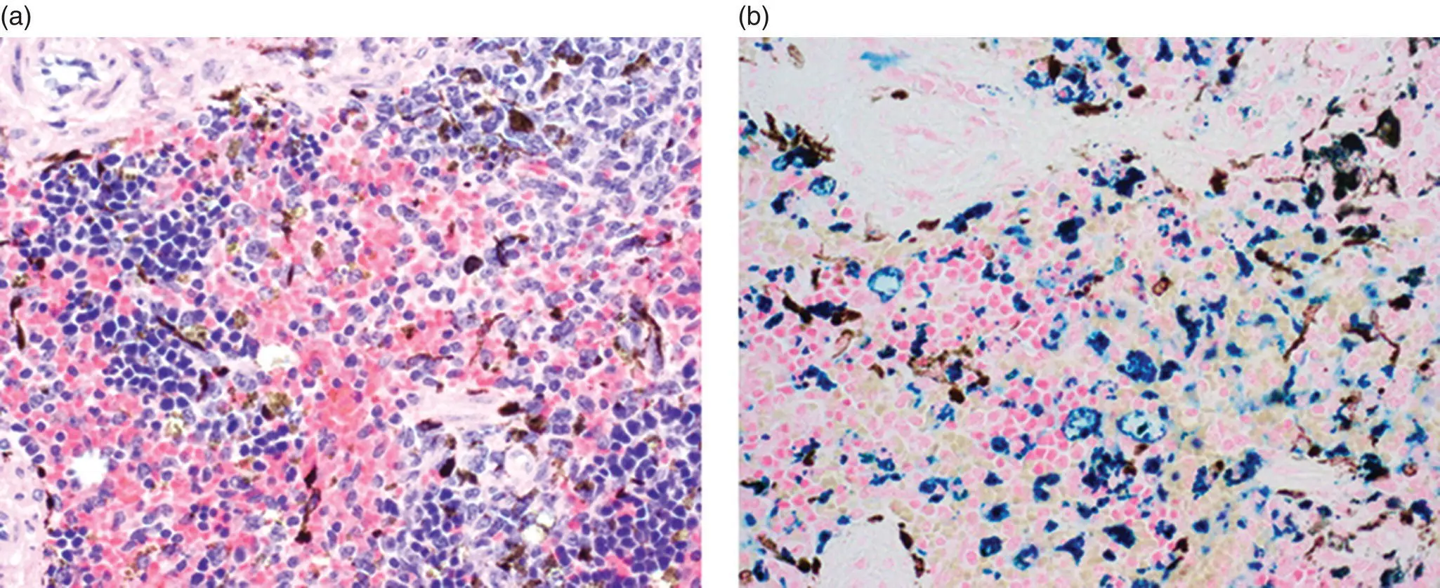Figure 77 Melanin vs hemosiderin a Spleen of B6Cg Prkdc scidSzJ mouse - фото 51