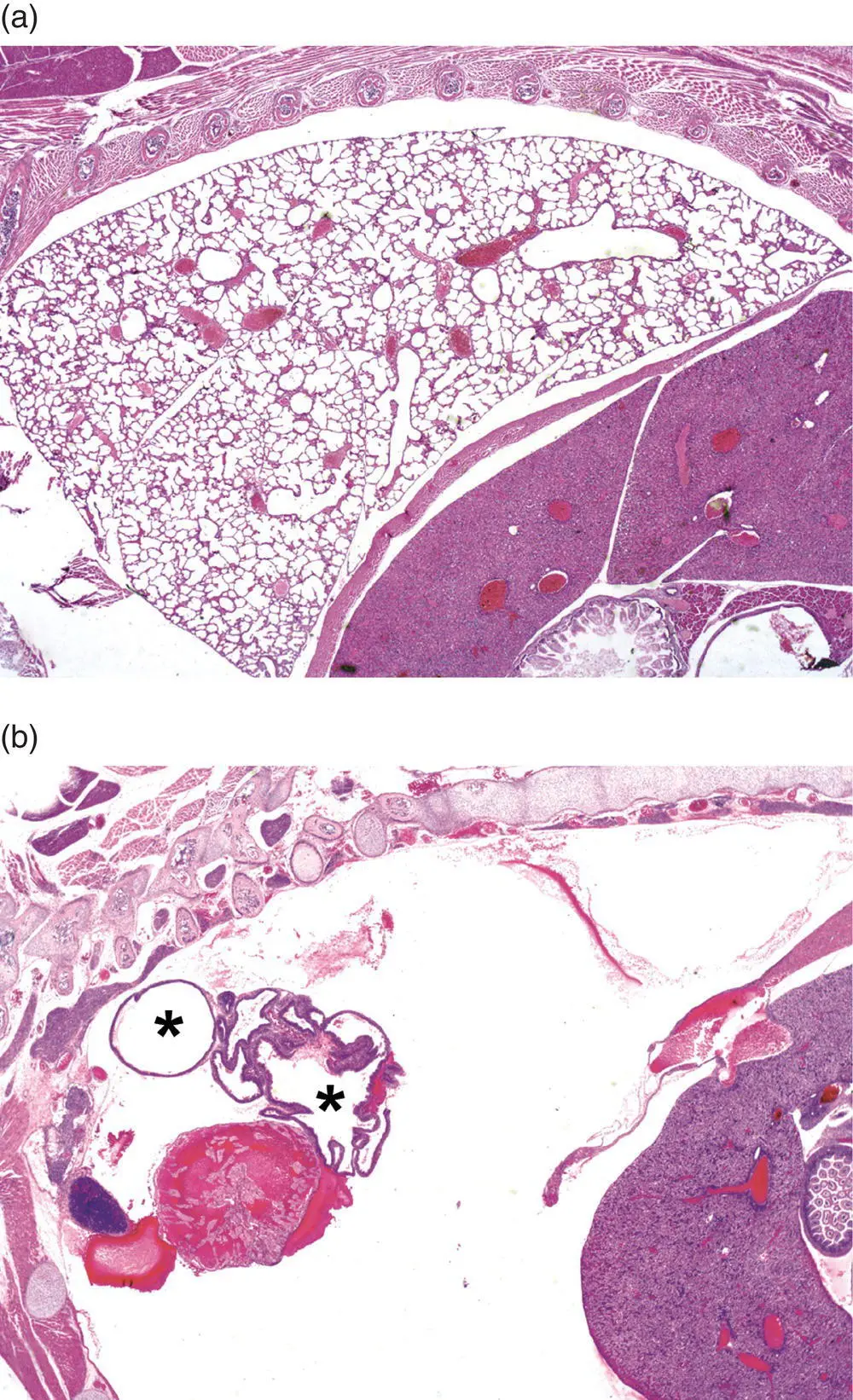 Figure 514 Missing structures represent a special situation in developmental - фото 33