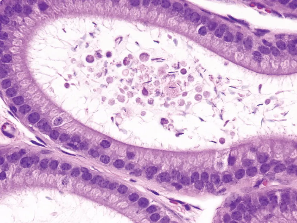 Figure 63 Epididymis Flagellar defects or dysfunction are common causes of - фото 45