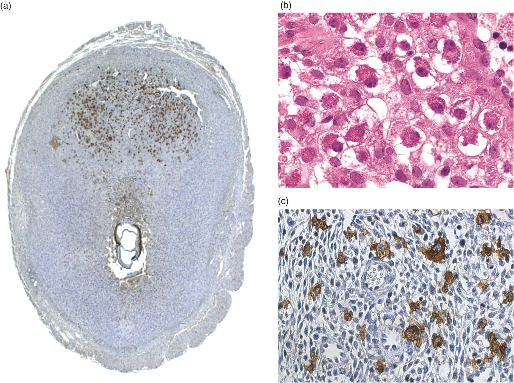 Figure 56 The nascent metrial gland also designated the mesometrial lymphoid - фото 25