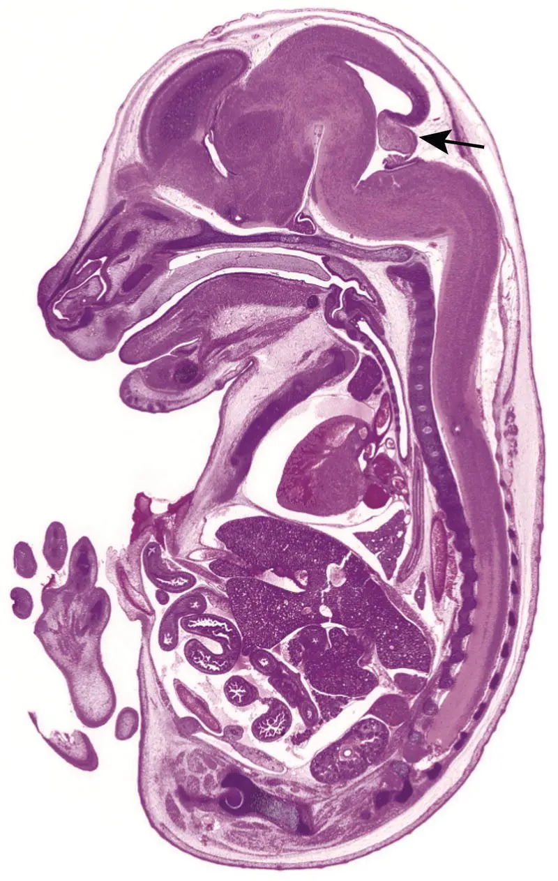 Figure 513 Developmental anatomy of a wildtype GD160 mouse embryo - фото 32