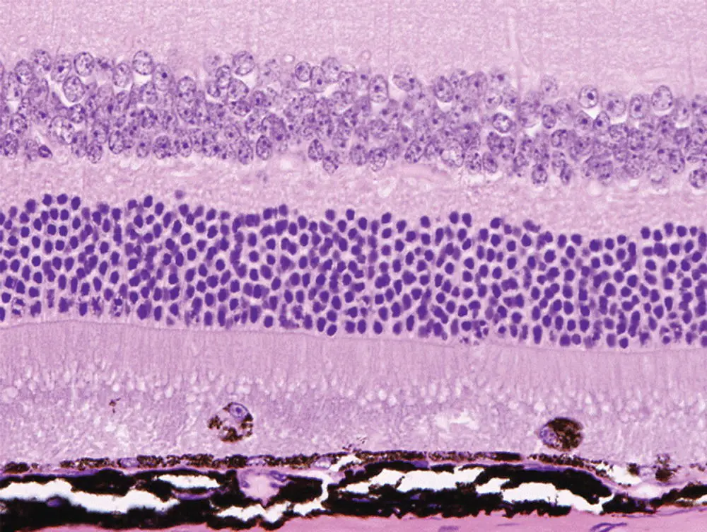 Figure 66 Eye Macrophages within the outer segment of photoreceptor are - фото 48