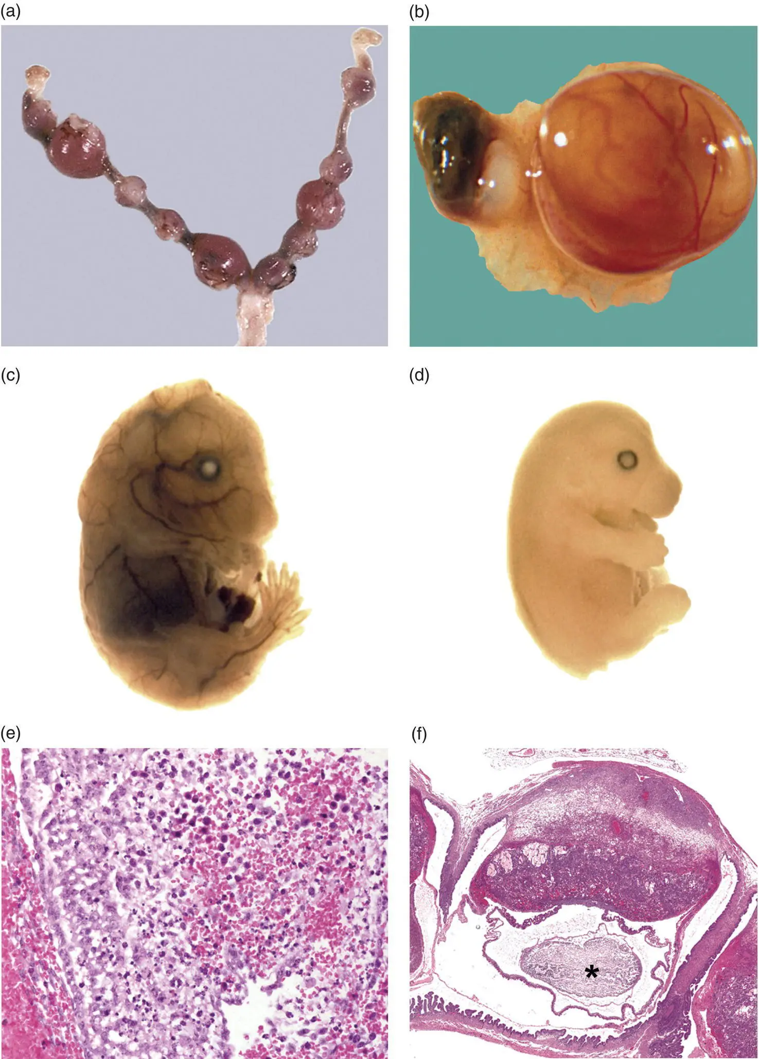 Figure 517 Embryonic death is demonstrated by a spectrum of macroscopic and - фото 36