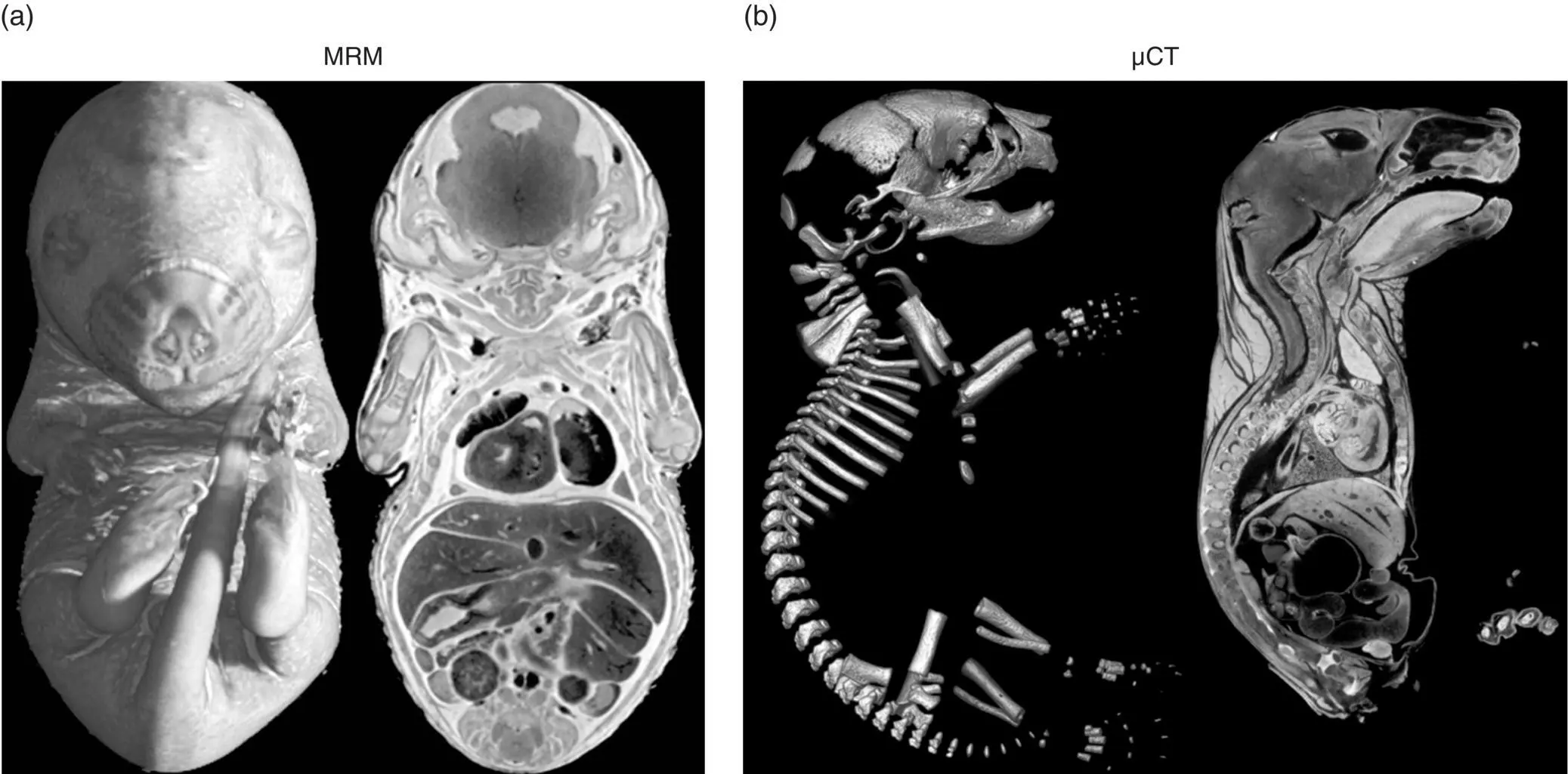 Figure 57 Noninvasive imaging modalities are useful means for characterizing - фото 26
