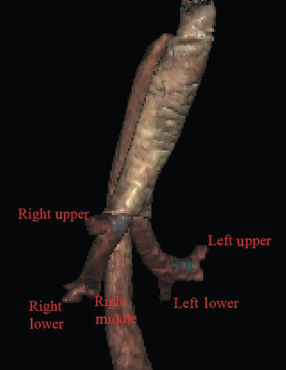 Figure 113 A Visible Human Model of the bronchial tree Chapter video clips - фото 15