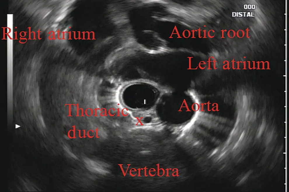 Figure 25 Radial array image at the level of the aortic root Figure 26 - фото 20