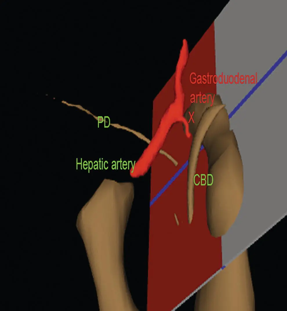 Figure 17 Visible Human Model with a plane that is in a location similar to - фото 9