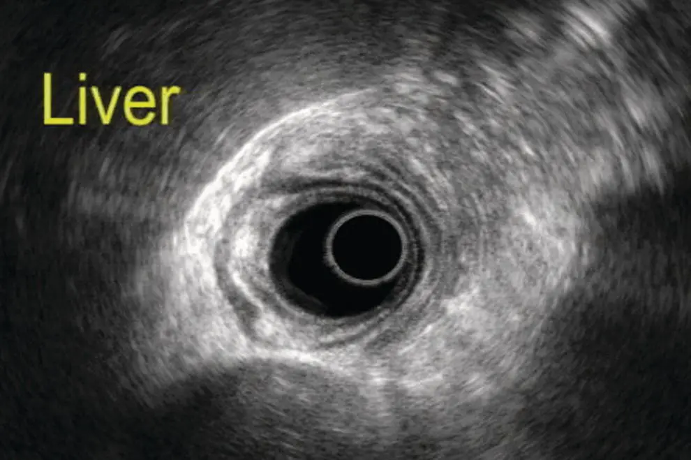 Figure 71 Image of the liver scanned by radial ultrasound Figure 72 Celiac - фото 59