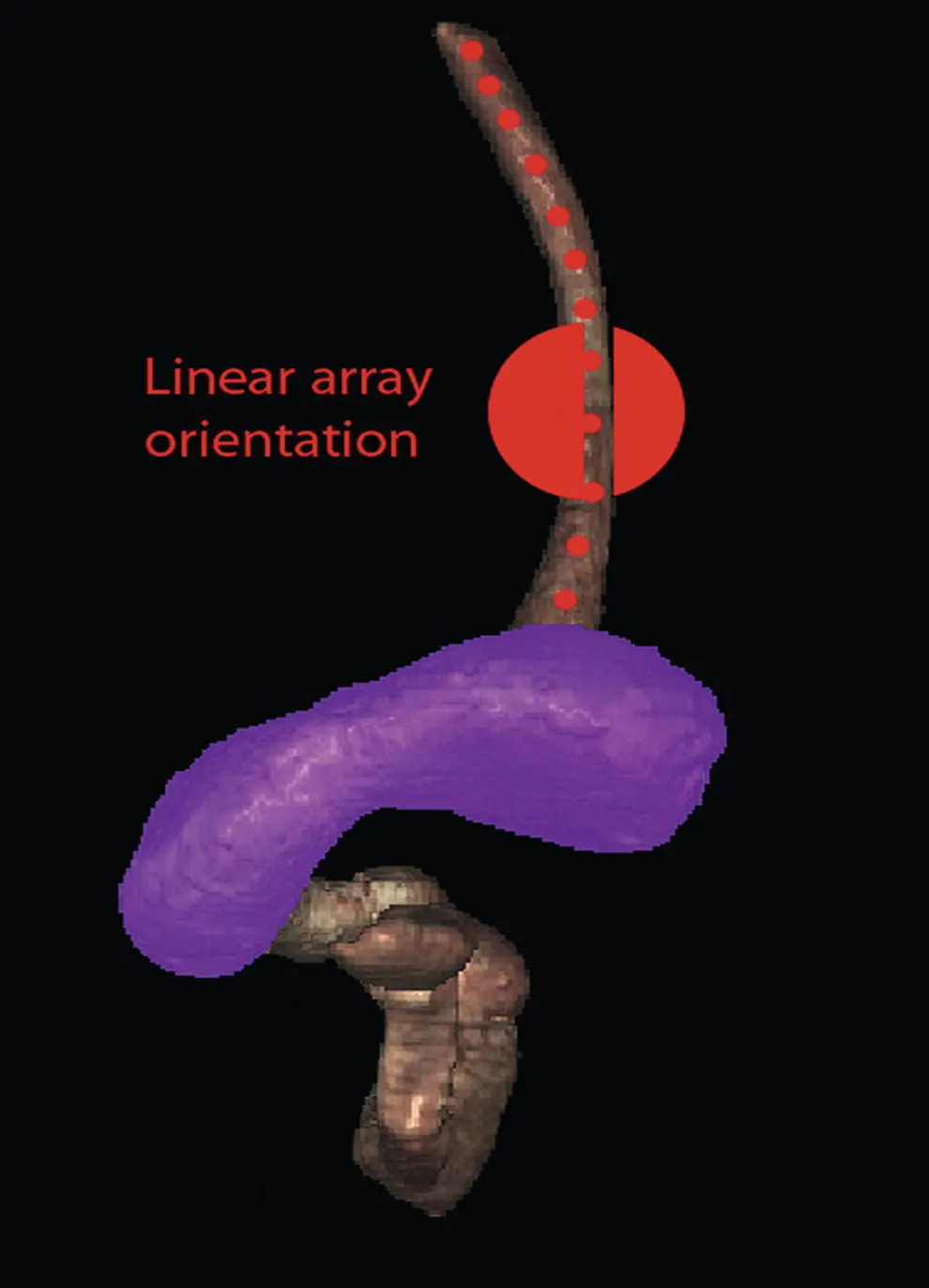 Figure 12 Visible Human Model of esophagus stomach and duodenum The red - фото 4