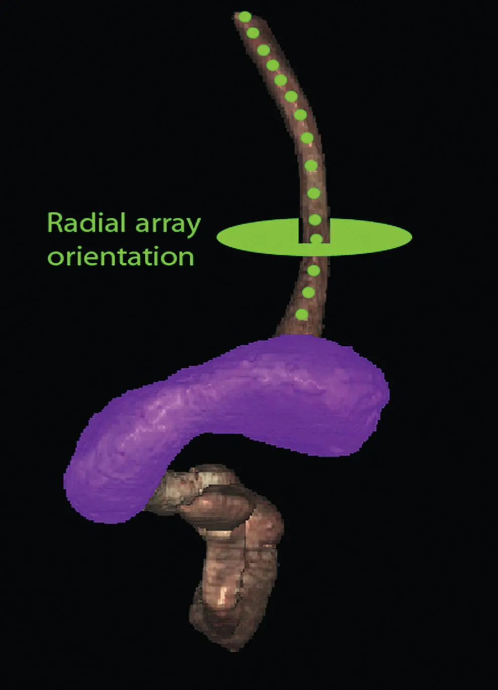 Figure 11 Visible Human Model of esophagus stomach and duodenum The green - фото 3