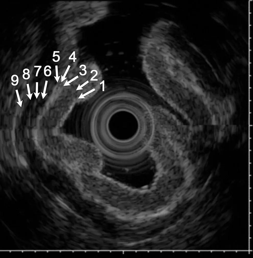 Figure 44 Ninelayer structure of the gastric wall obtained with a 20 MHz - фото 38