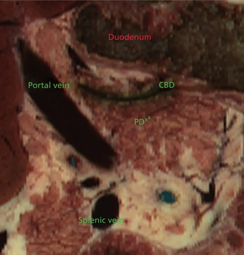 Figure 16 The crosssectional anatomy within the plane shown in Figure 13 - фото 8