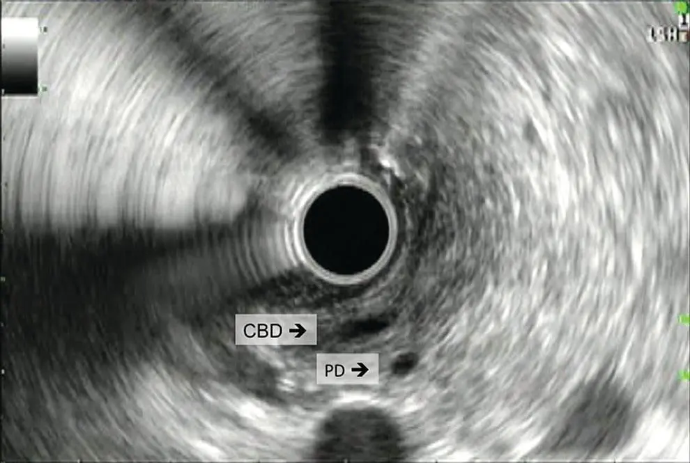 Figure 54 Bile duct and pancreatic duct from the second portion of the - фото 42