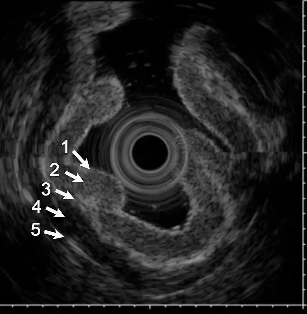 Figure 42 Fivelayer structure of the gastric wall demonstrating a relatively - фото 36