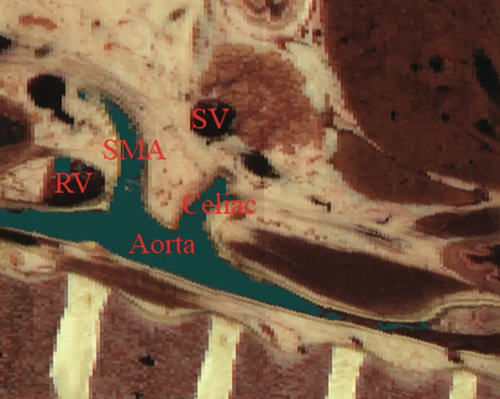 Figure 14 Sagittal crosssection of digital anatomy at the level of the - фото 6
