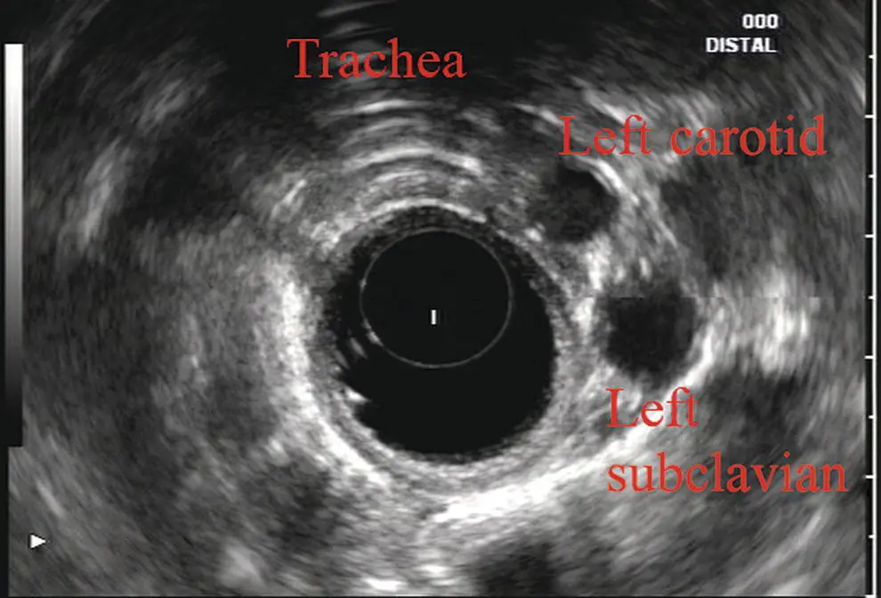 Figure 28 Radial array image at the level of the left carotid and subclavian - фото 23