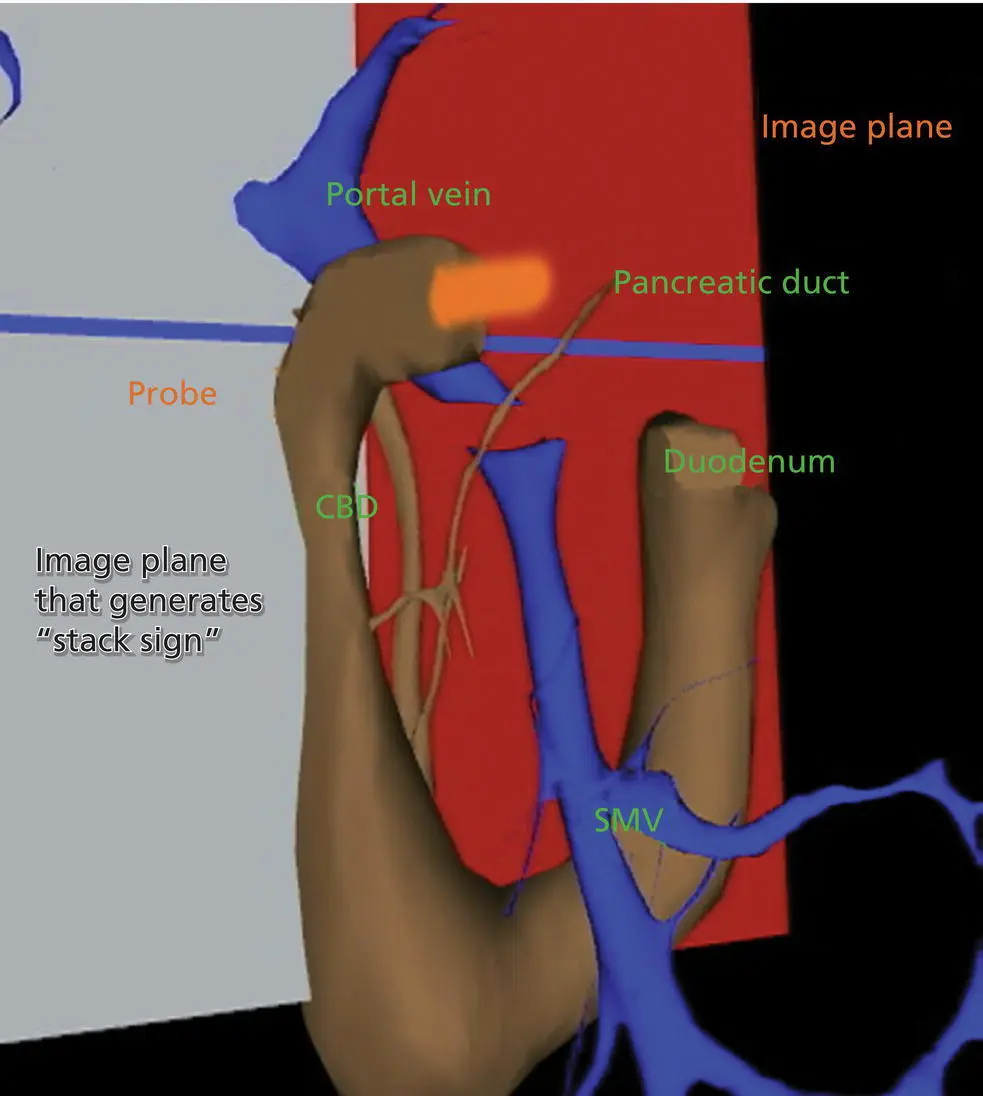 Figure 15 Visible Human Model of an image plane that is in the location in - фото 7