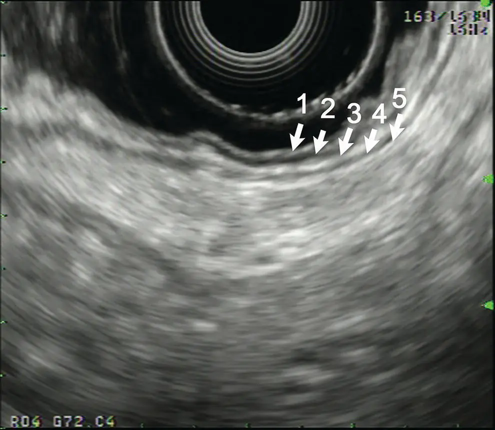 Figure 43 Fivelayer structure of the gastric wall obtained with an electronic - фото 37