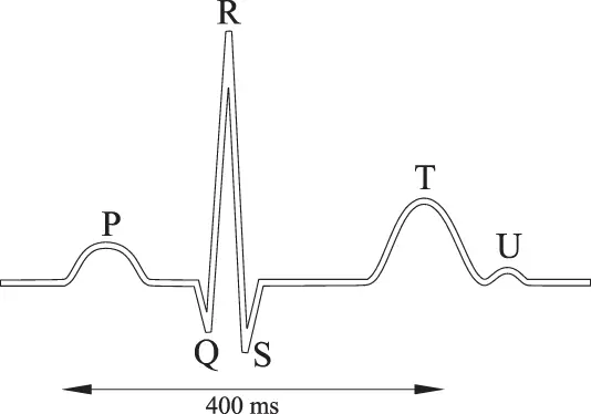 Figure 12 A normal electrocardiogram EKG During the P wave the right and - фото 3