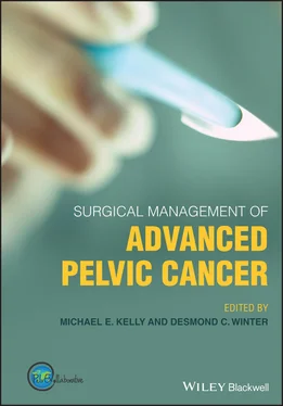 Неизвестный Автор Surgical Management of Advanced Pelvic Cancer обложка книги